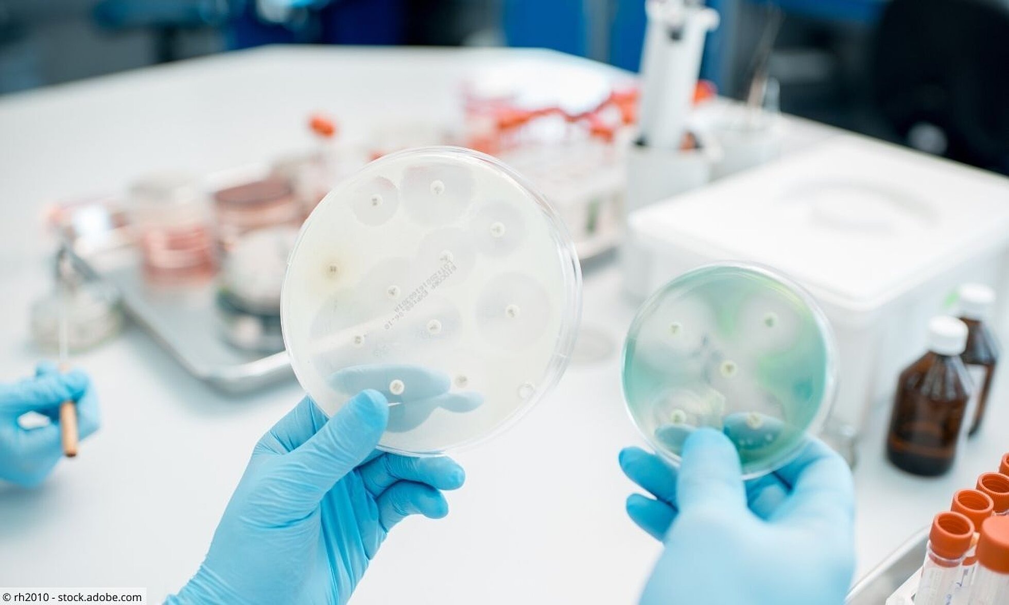 Petrischalen mit Bakterienkulturen